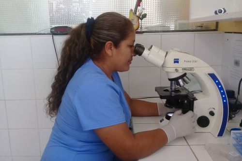 Se ha registrado un incremento de nuevos casos de VIH en el Hospital La Caleta de Chimbote con respecto al año pasado.