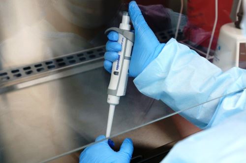 En marzo pasado el laboratorio envió al INS 100 muestras al azar recogidas desde los primeros días de ese mes para un estudio sobre la exposición del virus.