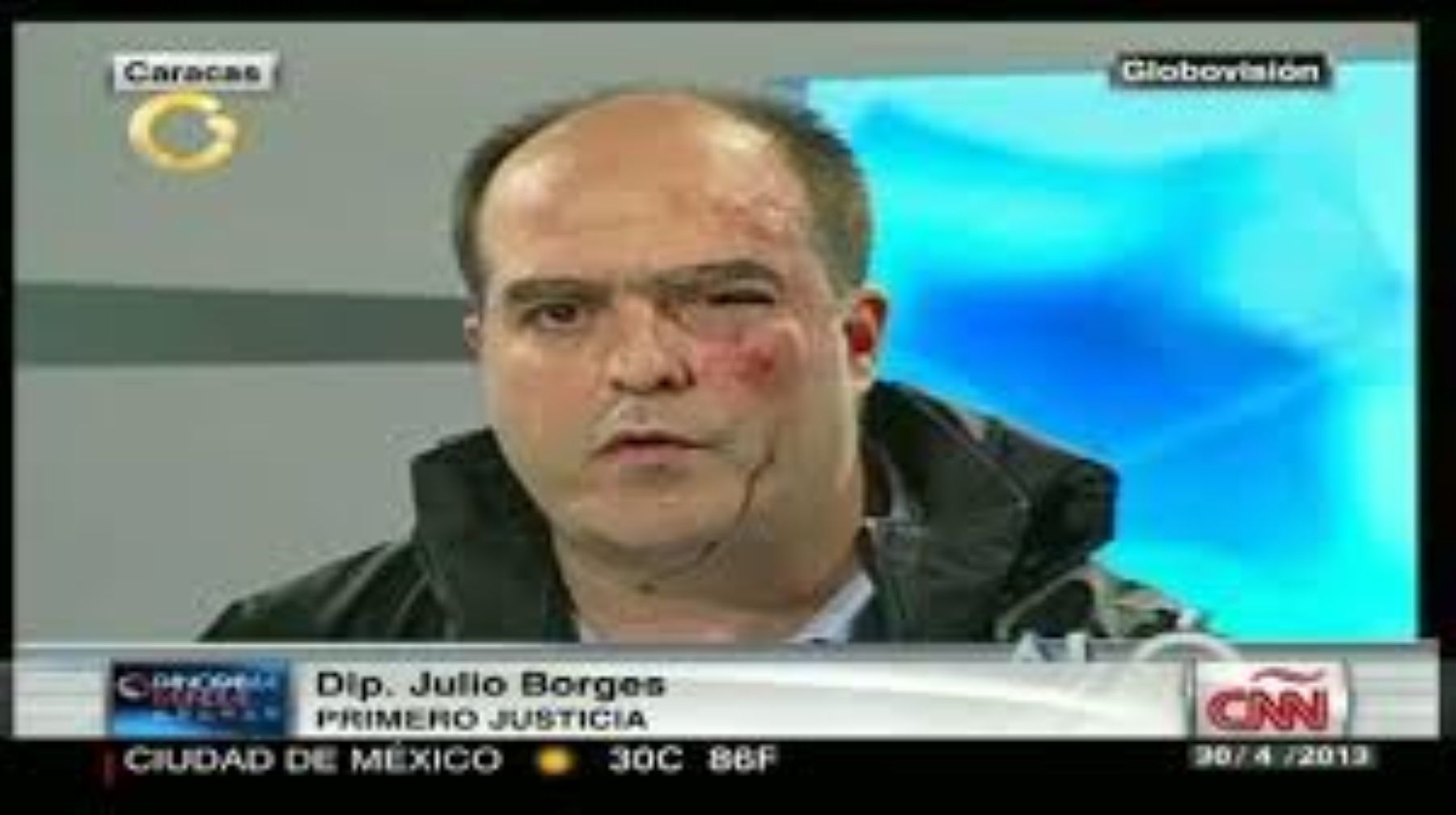 Cadenas internacionales como la CNN mostraron a los diputados venezolanos que fueron agredidos.