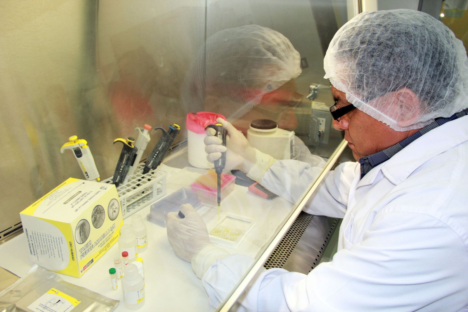 El primer kit de diagnóstico de fiebre amarilla en el mundo es creación de investigadores peruanos. Foto: Andina/Difusión