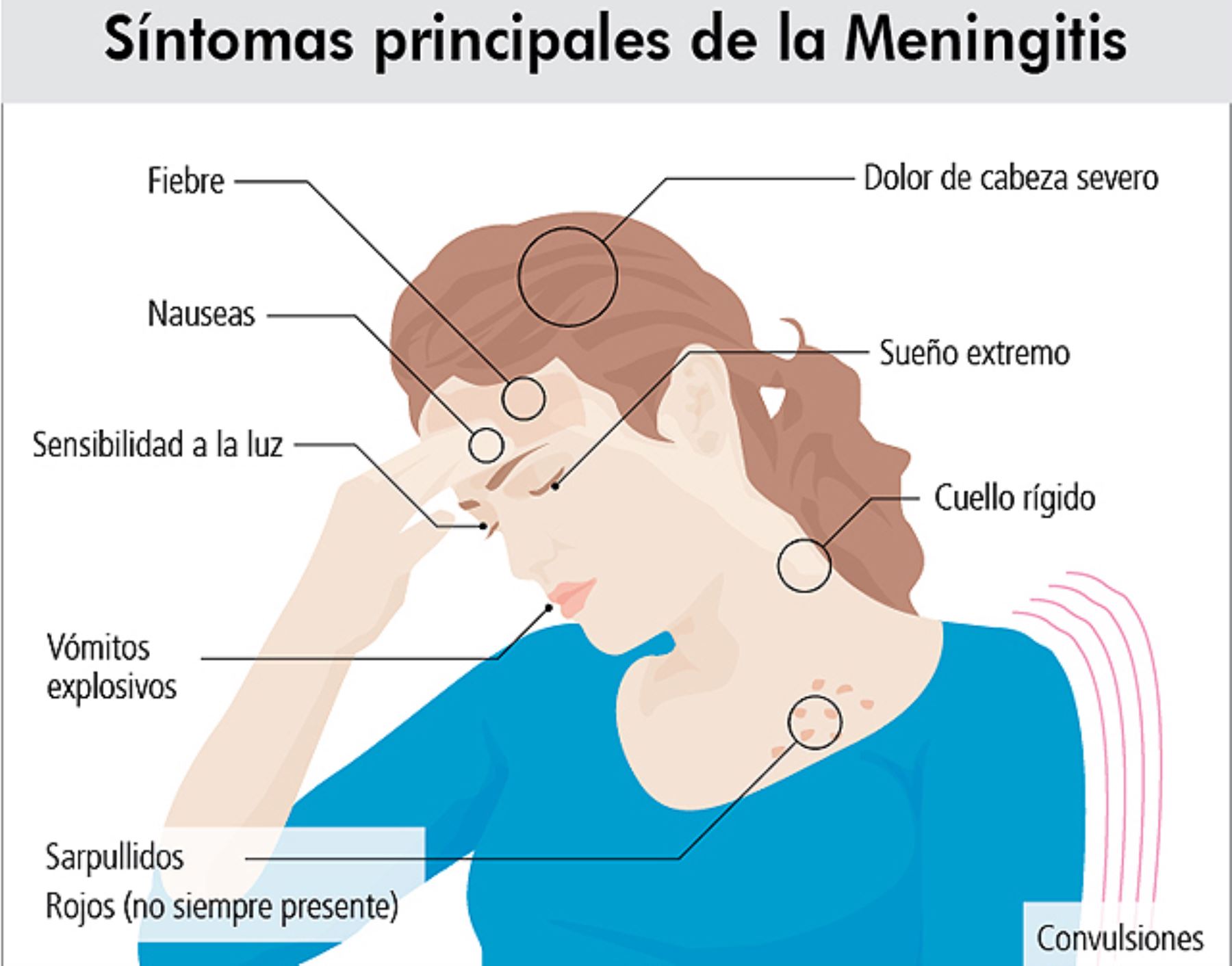 Síntomas de la meningitis. Foto: ANDINA/Difusión.