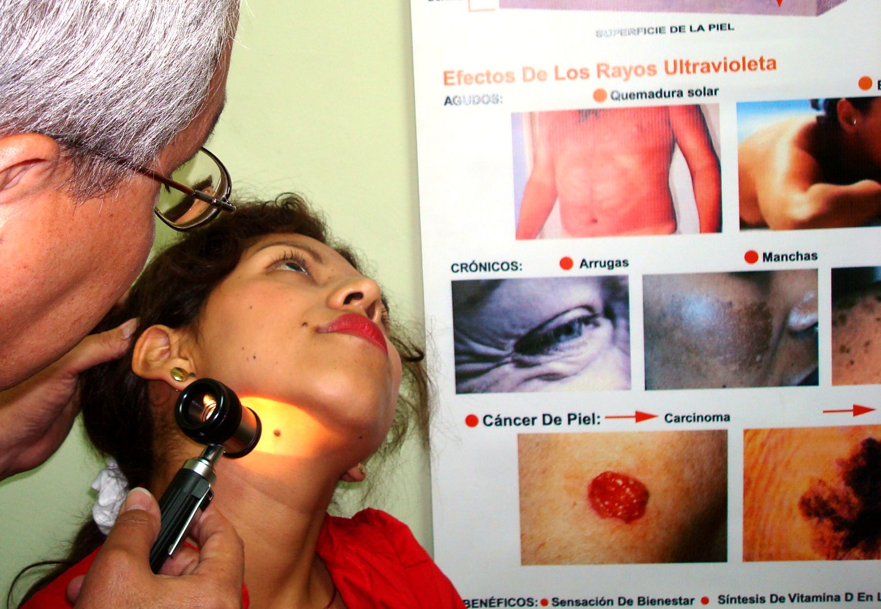 Lunares que causan dolor o comezón pueden ser inicio de cáncer de piel |  Noticias | Agencia Peruana de Noticias Andina