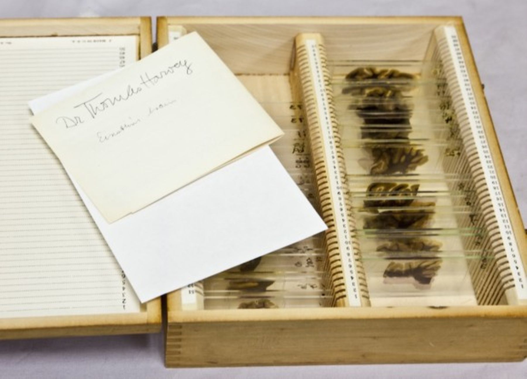 Caja con la muestra del cerebro de Albert Einstein. Foto: ANDINA/Internet.