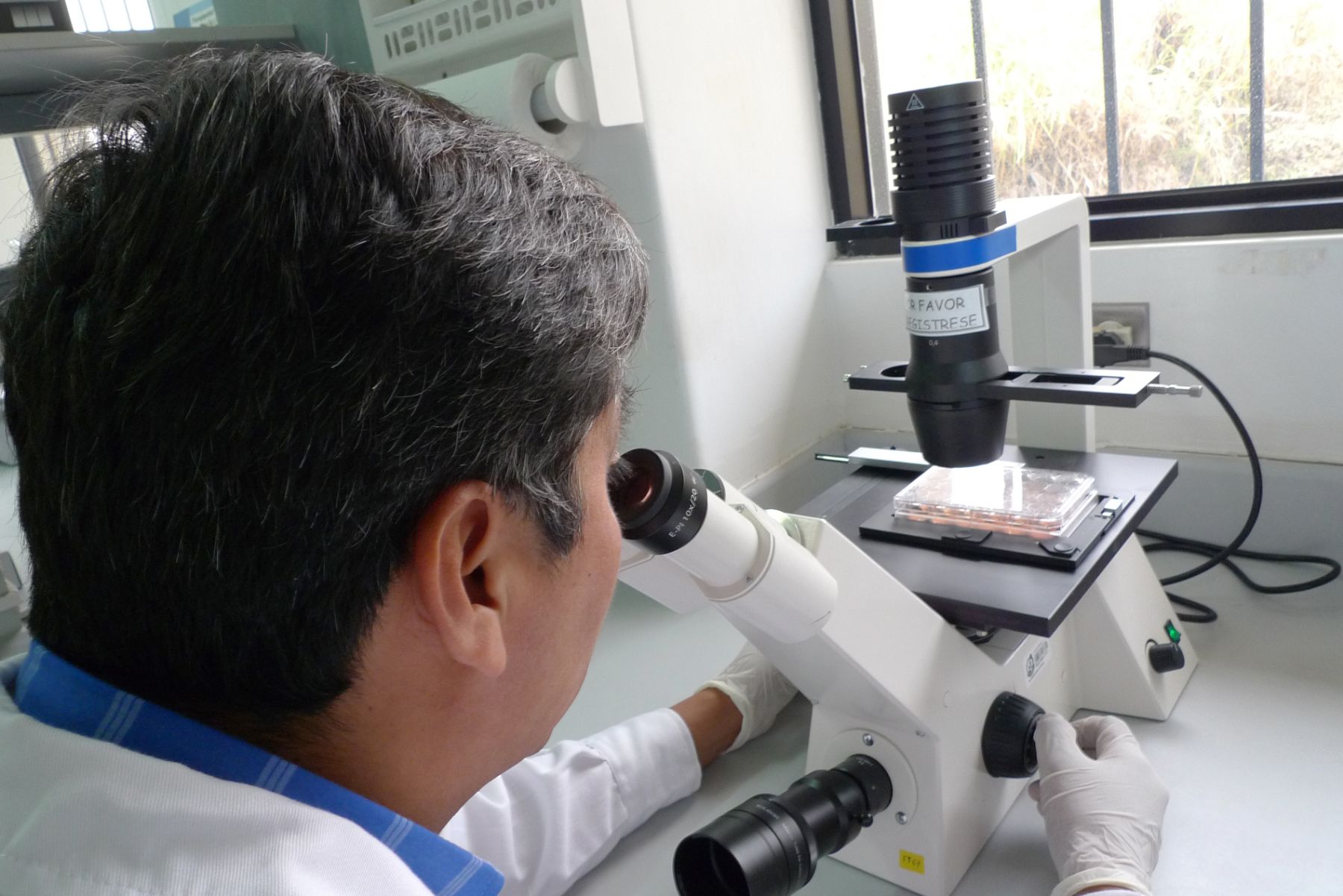 Investigadores del INS investigan uso de tecnología para realizar diagnóstico oportuno de enfermedad de Carrión o verruga Peruana.ANDINA