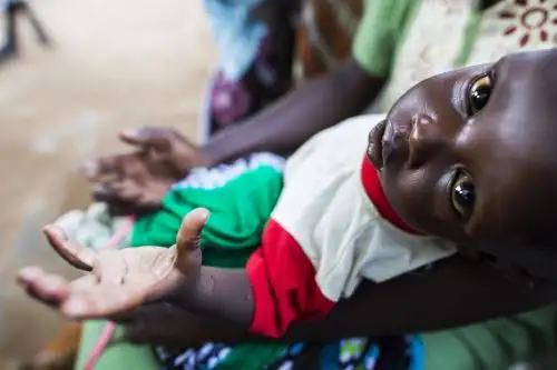 Informe de Oxfam advierte que el problema del hambre se agudizará en África. AFP
