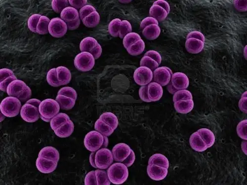 Un 20% de los que sobreviven a la enfermedad, queda afectado con discapacidades mentales o físicas. Foto: Difusión