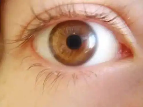 Test de ojos para detectar parkinson. Internet/Medios