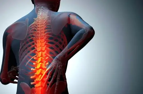 Pese a ser menos frecuente, osteoporosis en hombres es tan severa como en la mujer. Foto: ANDINA/Difusión.