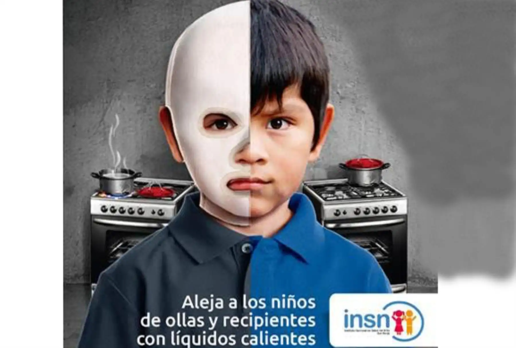 No más niños quemados. Foto: ANDINA/Difusión.