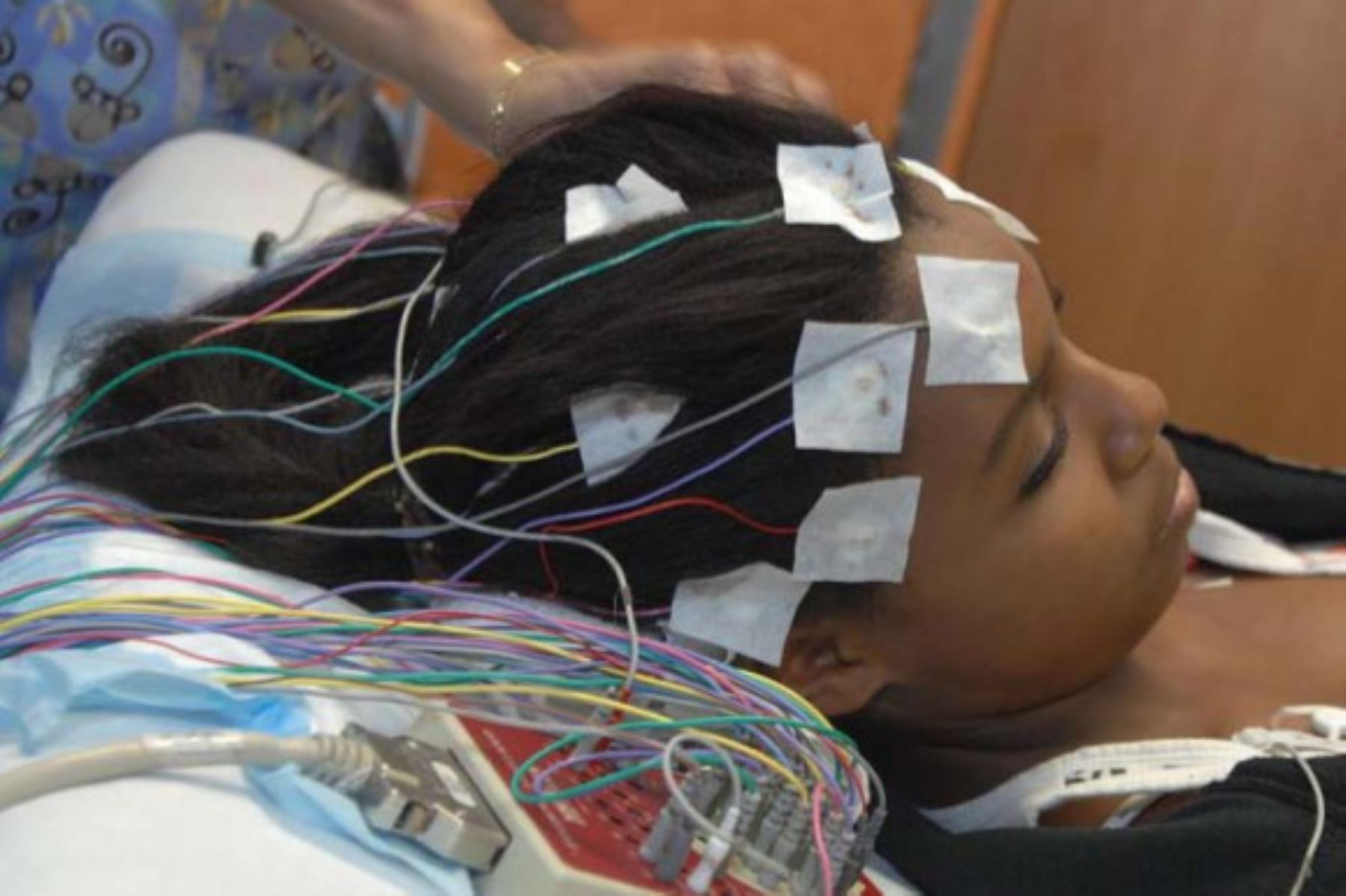 Buscan mejorar calidad de vida de pacientes con epilepsia refractaria con implantes médicos. Foto: Andina/Difusión