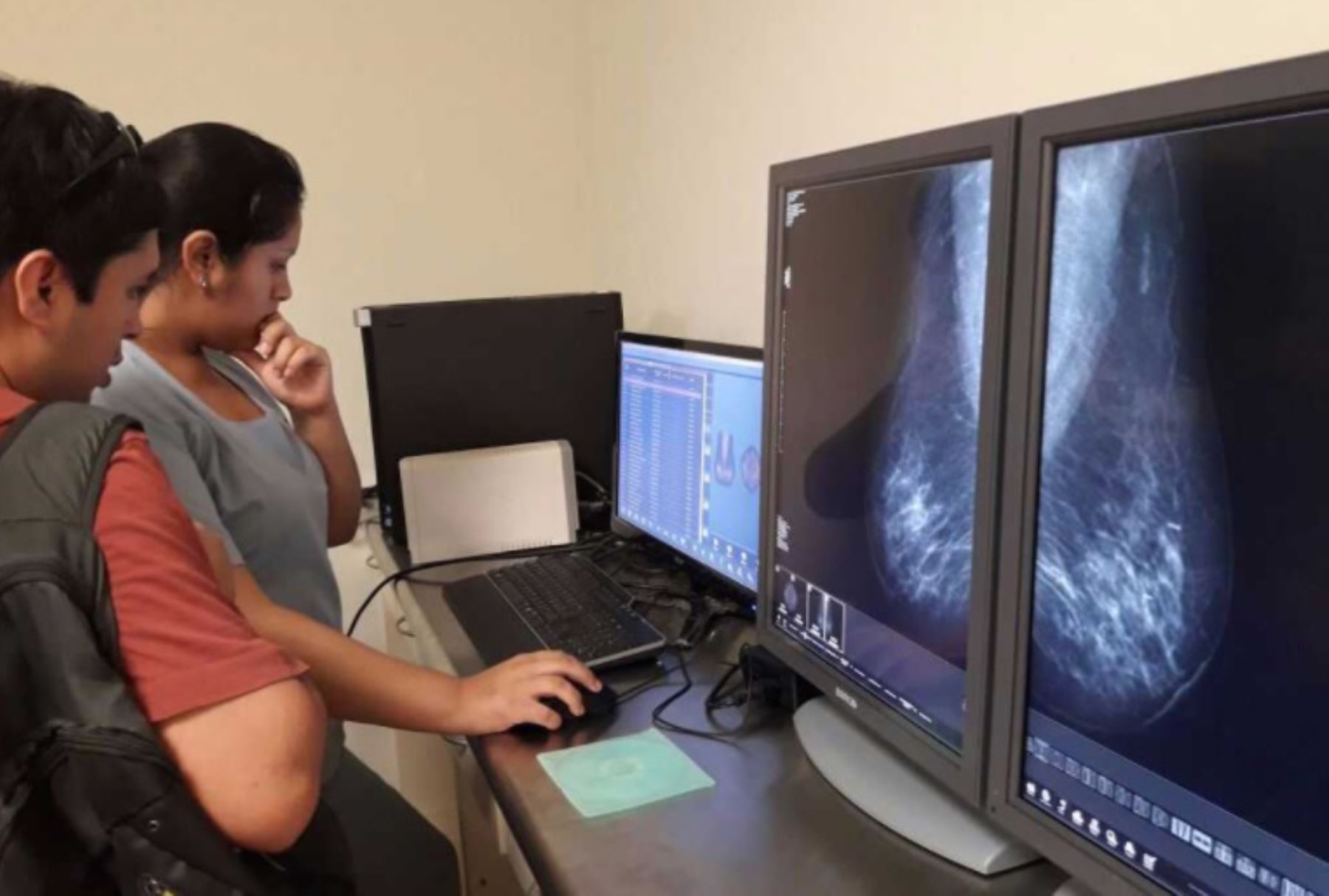 Junín: Minsa implementa Telemamografía para diagnósticos oportunos