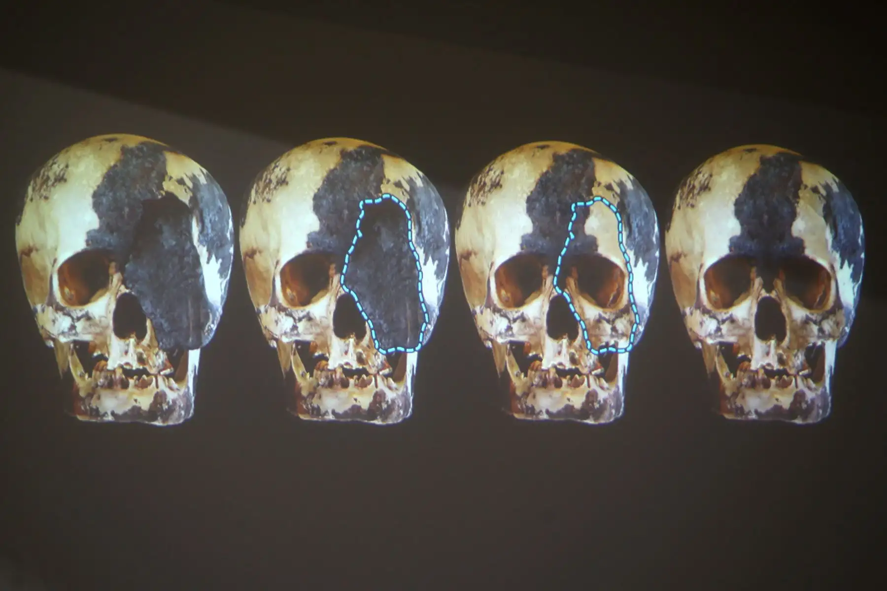 El misterio que embargaba sobre la identidad de una mujer de alto estatus social en la civilización Caral, llamada la “Dama de los Cuatro Tupus”, cuyos restos fueron encontrados en el sitio arqueológico Áspero, fue revelado hoy con la presentación de su rostro reconstruido gracias a la tecnología en tercera dimensión o 3D. ANDINA/Melina Mejía