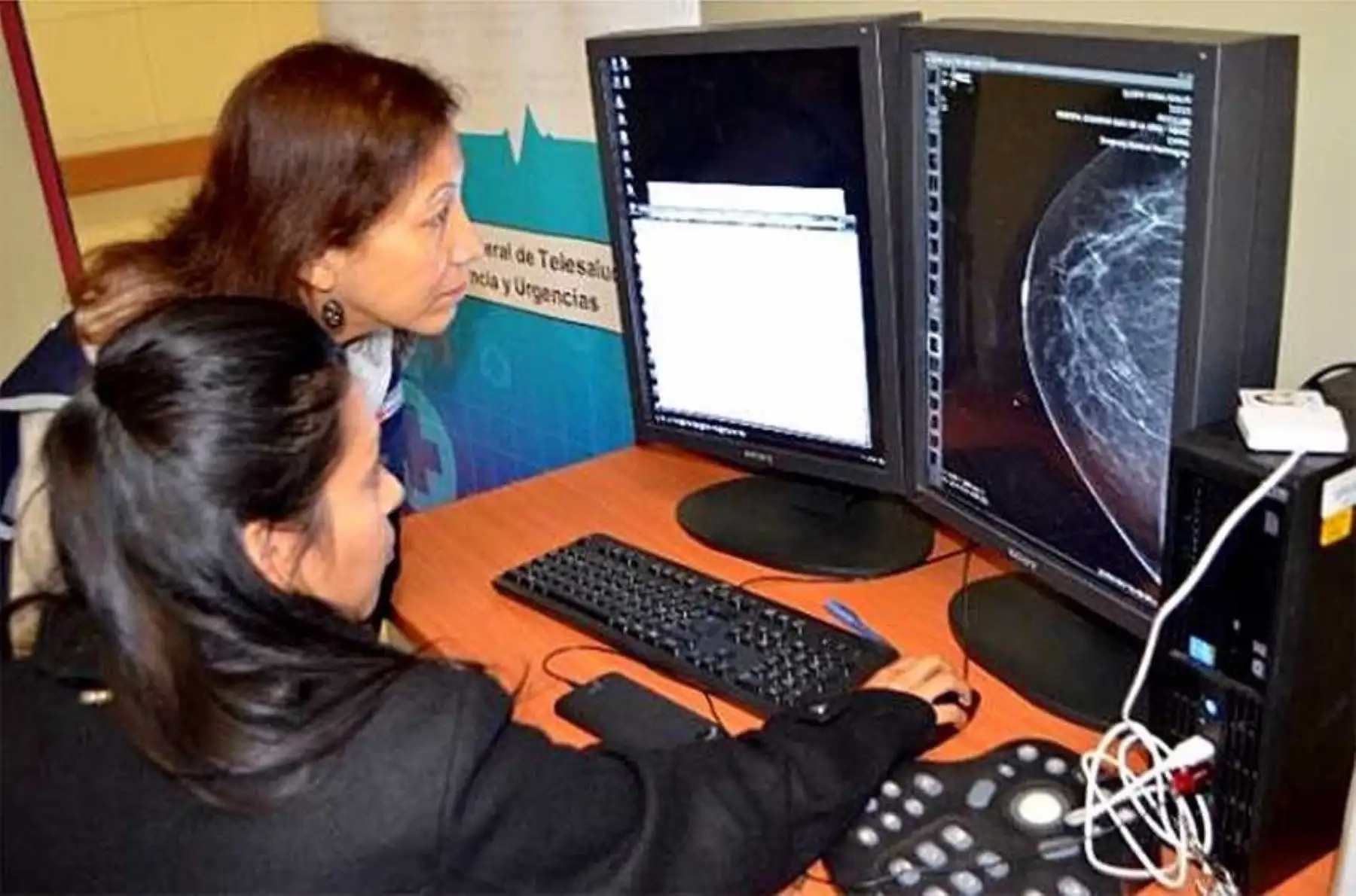 Las regiones de Junín y Puno lideran el acceso a las telemamografías para el diagnóstico oportuno del cáncer de mama, servicio del Ministerio de Salud (Minsa) que registra hasta ahora 1,056 atenciones a igual número de pacientes mujeres a escala nacional.
