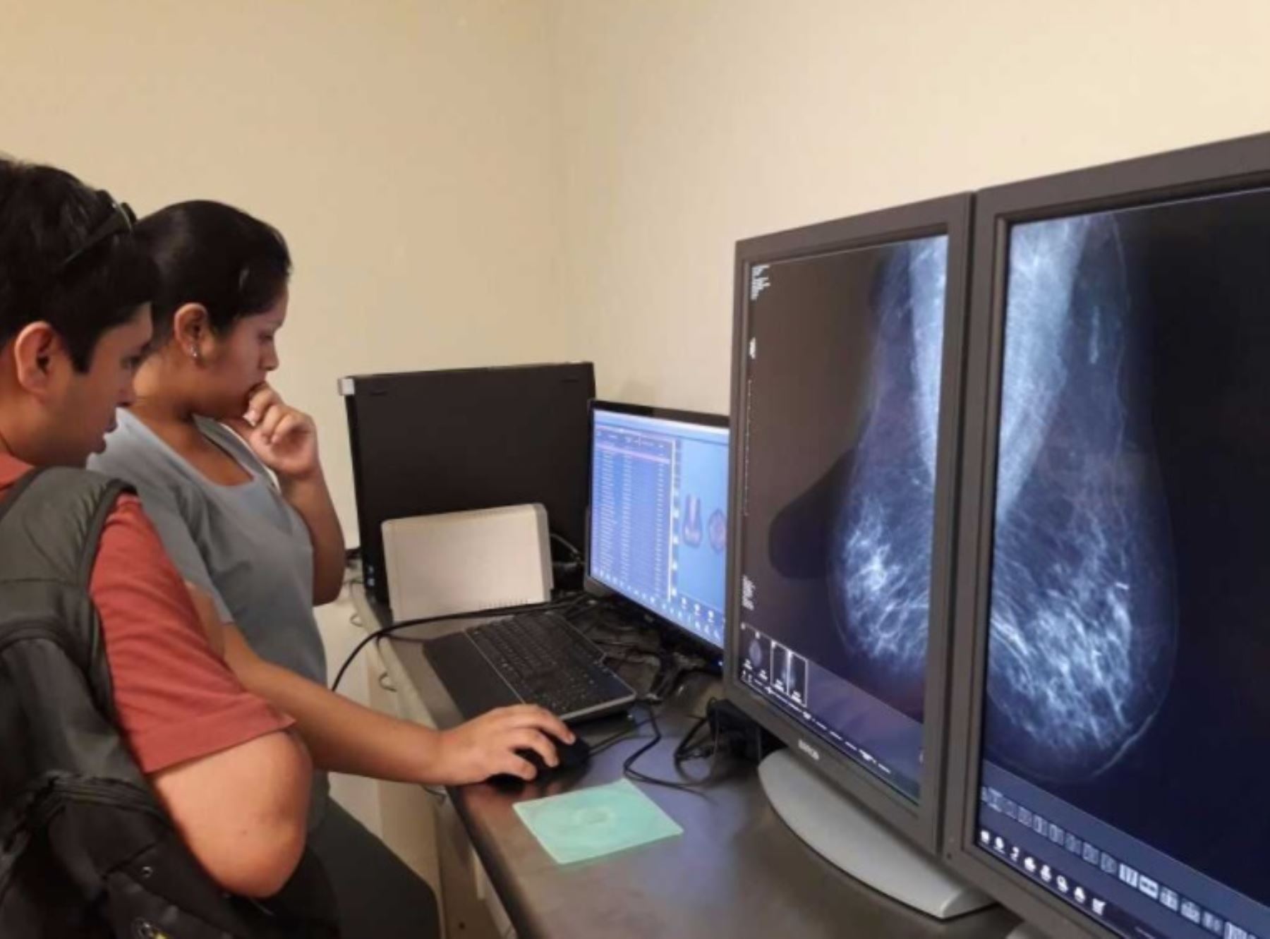 Las regiones de Junín y Puno lideran el acceso a las telemamografías para el diagnóstico oportuno del cáncer de mama, servicio del Ministerio de Salud (Minsa) que registra hasta ahora 1,056 atenciones a igual número de pacientes mujeres a escala nacional.
