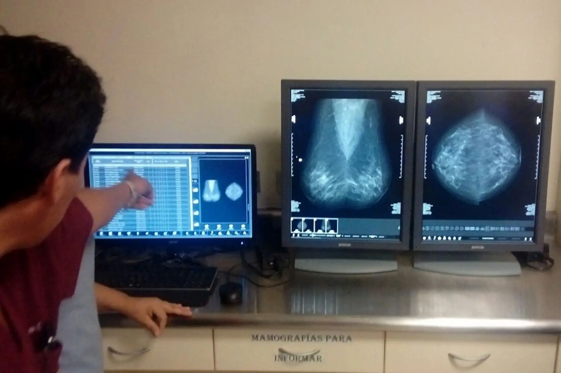 Minsa implementará servicio de Telesalud en frontera con Colombia.