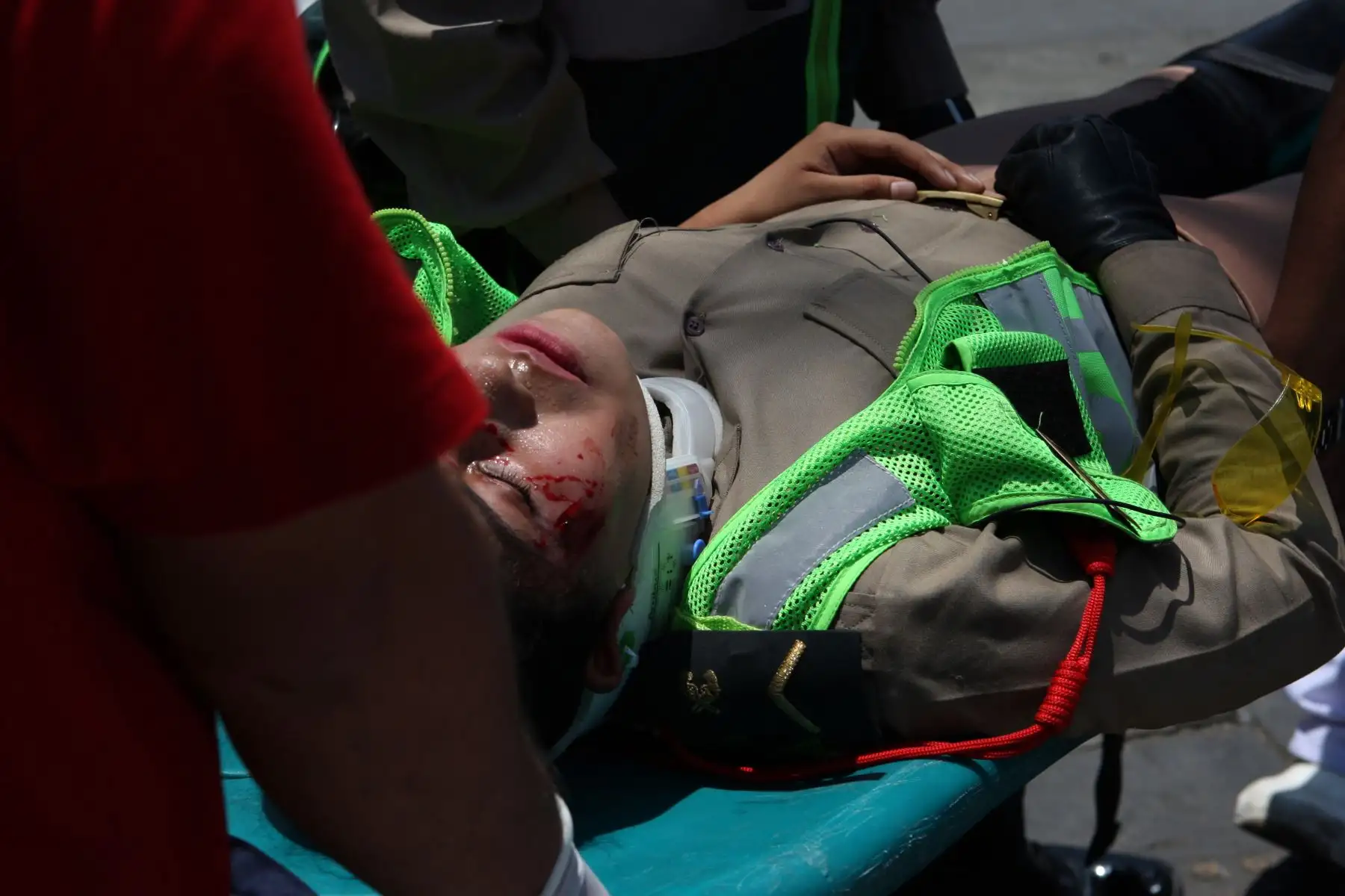 LIMA,PERÚ.ENERO 24. Policías motorizadas SO3 Sandra Saavedra Rosales y SO3 Lisset Ramírez Domínguez, de la Dirtran, quedan gravemente heridas al ser atropelladas por patrullero. Foto: ANDINA/Héctor Vinces.