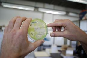 Las dos bacterias a analizar serán la E. coli y la Pseudomonas aeruginosa, que pueden producir graves enfermedades al ser humano. Foto: AFP