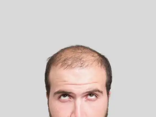 Hallan método de cultivo de cabello. Foto: AFP
