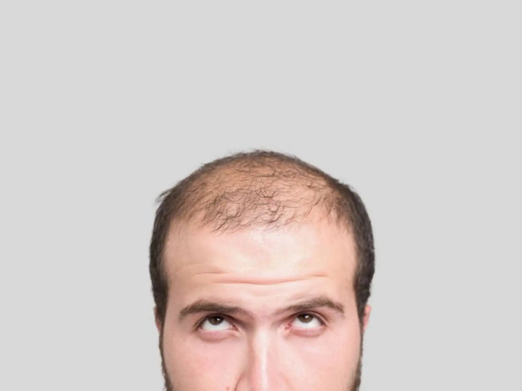Hallan método de cultivo de cabello. Foto: AFP