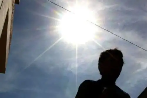 La radiación ultravioleta forma parte de los rayos solares y es necesaria para la vida en nuestro planeta. Sin embargo, cuando alcanza niveles elevados se convierte en una amenaza para la salud humana, provocando entre otros daños, el cáncer de piel. ANDINA/Difusión
