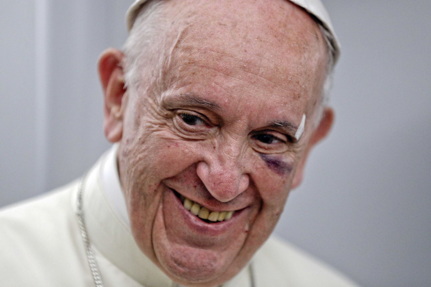 Papa Francisco sufrió un golpe en la cara en Colombia. Foto: AFP