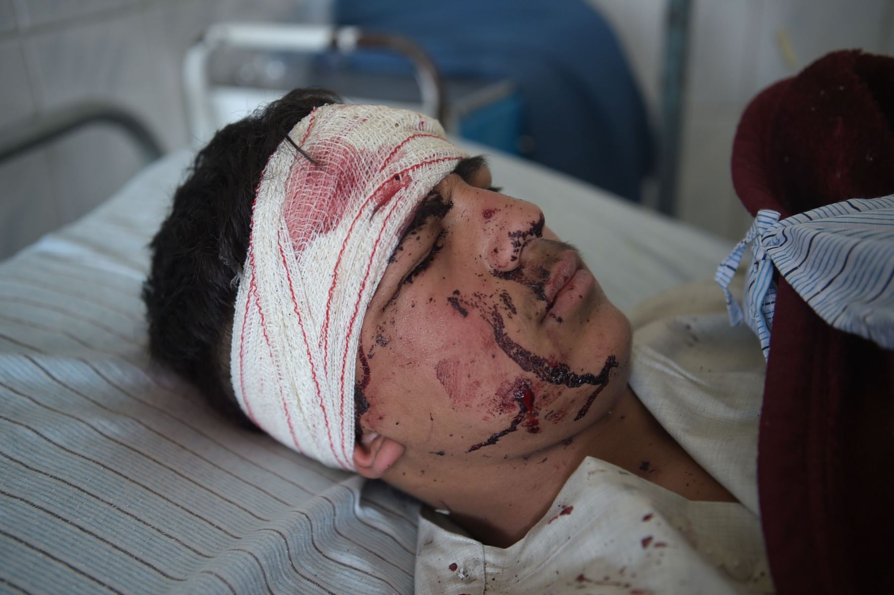 Atentado suicida en Kabul. Foto: AFP