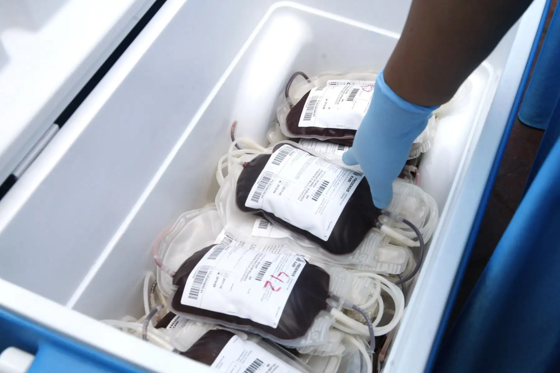 Campaña de Salud " Dale Vida", donar sangre es donar vida, organizado por el Ministerio de Salud y la municipalidad de Magdalena. Foto: ANDINA/Eddy Ramos.