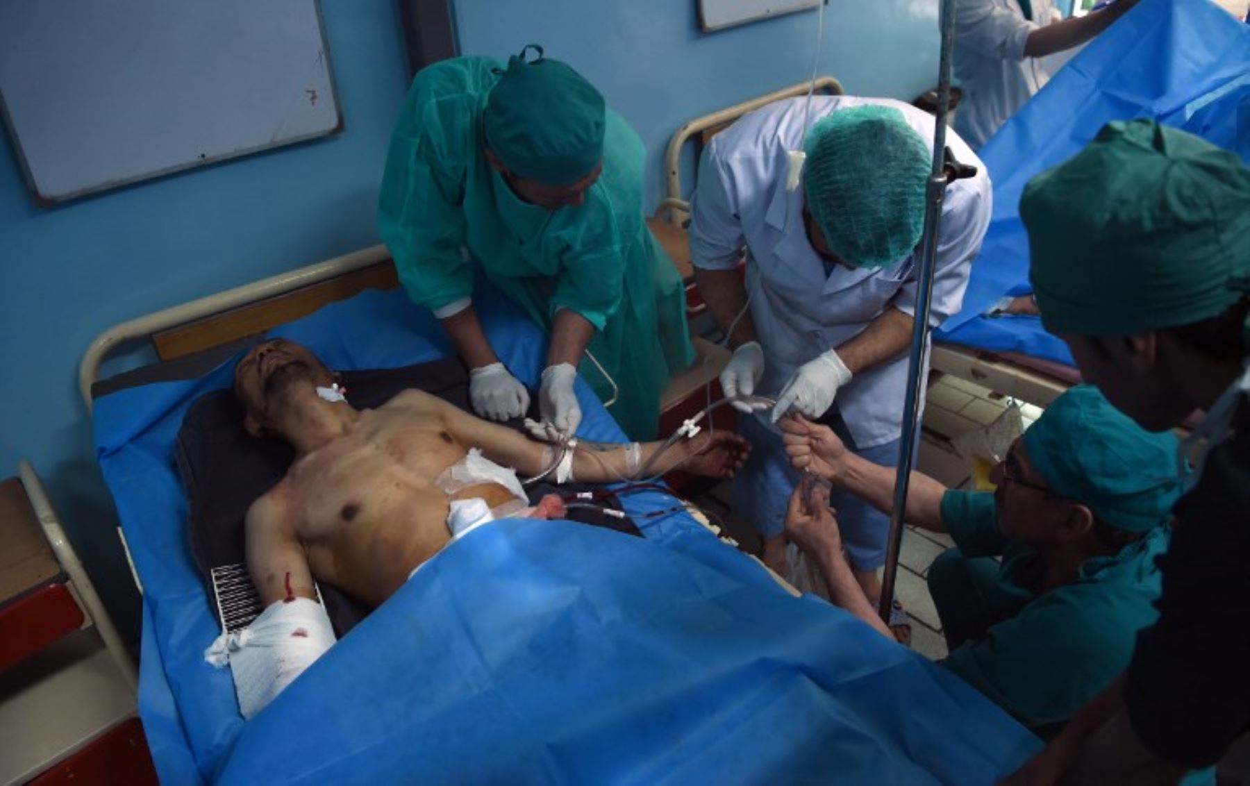Un residente afgano herido es atendido después de un atentado suicida en el Hospital Isteqlal en Kabul.Foto:AFP
