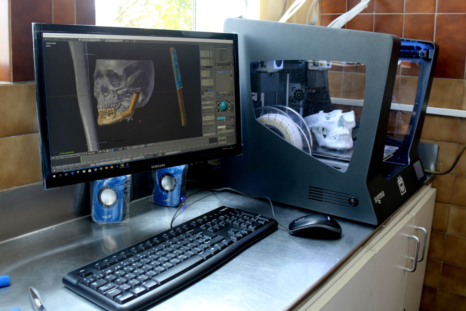 Impresora 3D es usada  para cirugías de alta complejidad en el INEN. Foto: Andina/Difusión