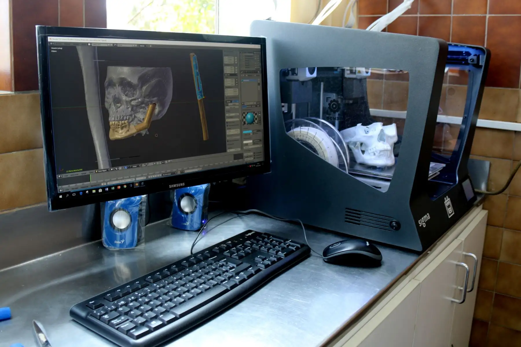 Impresora 3D es usada  para cirugías de alta complejidad en el INEN. Foto: Andina/Difusión