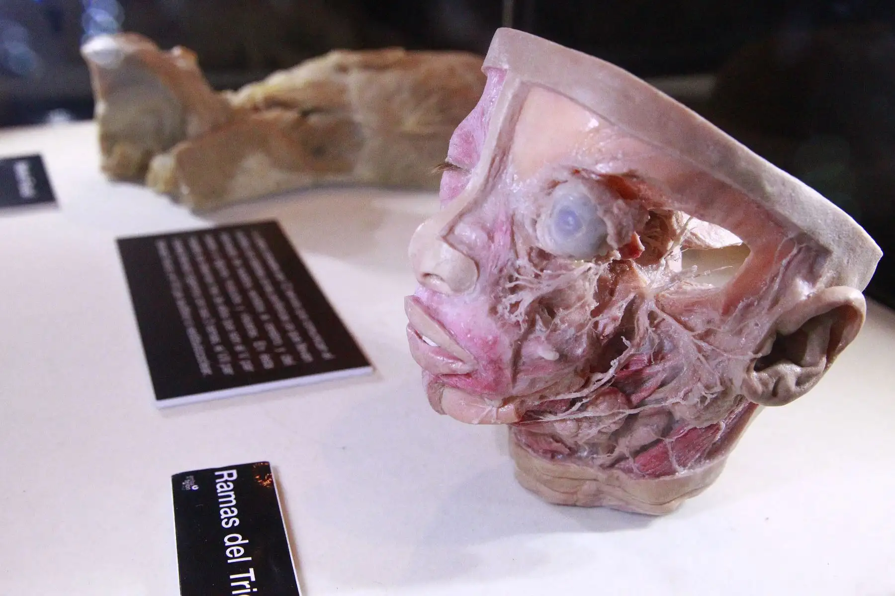 La impactante muestra Bodies, Cuerpos humanos reales se encuentra de paso por Lima para mostrarnos cómo funciona el organismo. Foto: ANDINA/Eddy Ramos