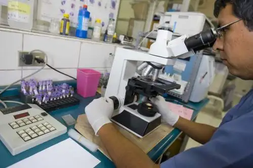 Personal del Ministerio de Salud (Minsa) y de la Dirección Regional de Salud (Diresa) de Tumbes viene realizando el cerco epidemiológico para identificar posibles casos de malaria en el distrito de caleta La Cruz, el centro poblado de Andrés Araujo y el distrito de Tumbes.