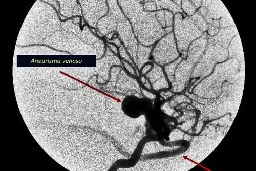 Advierten incremento de casos de niños con lesiones vasculares en el cerebro. Foto: ANDINA/Difusión.