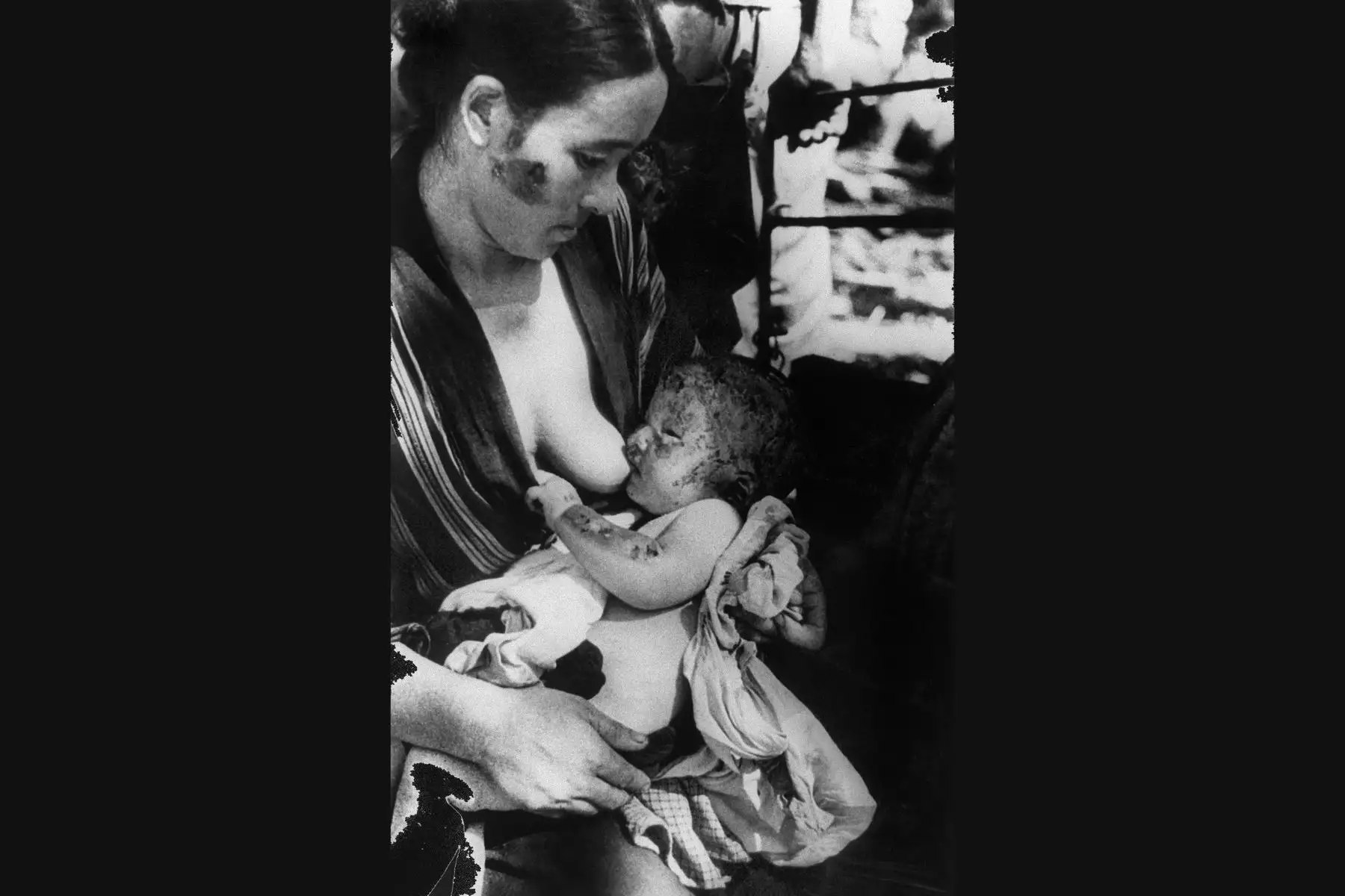 Imagen del 10 de agosto de 1945 de una mujer que amamanta a su hijo quemado después del bombardeo atómico en Hiroshima por el ejército de los Estados Unidos 06 de agosto de 1945. / AFP