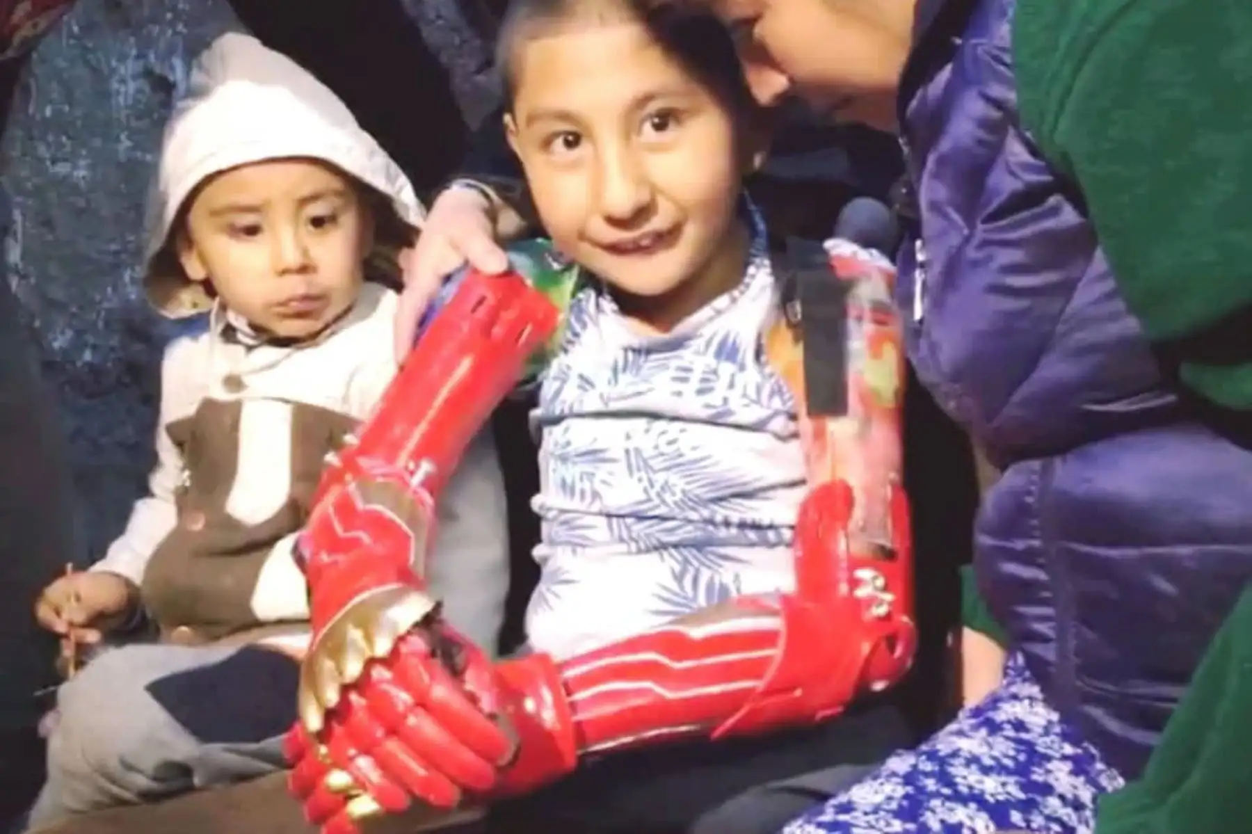 Niño cusqueño recibe prótesis de brazos elaboradas con impresión 3D. Foto: ANDINA/Difusión.