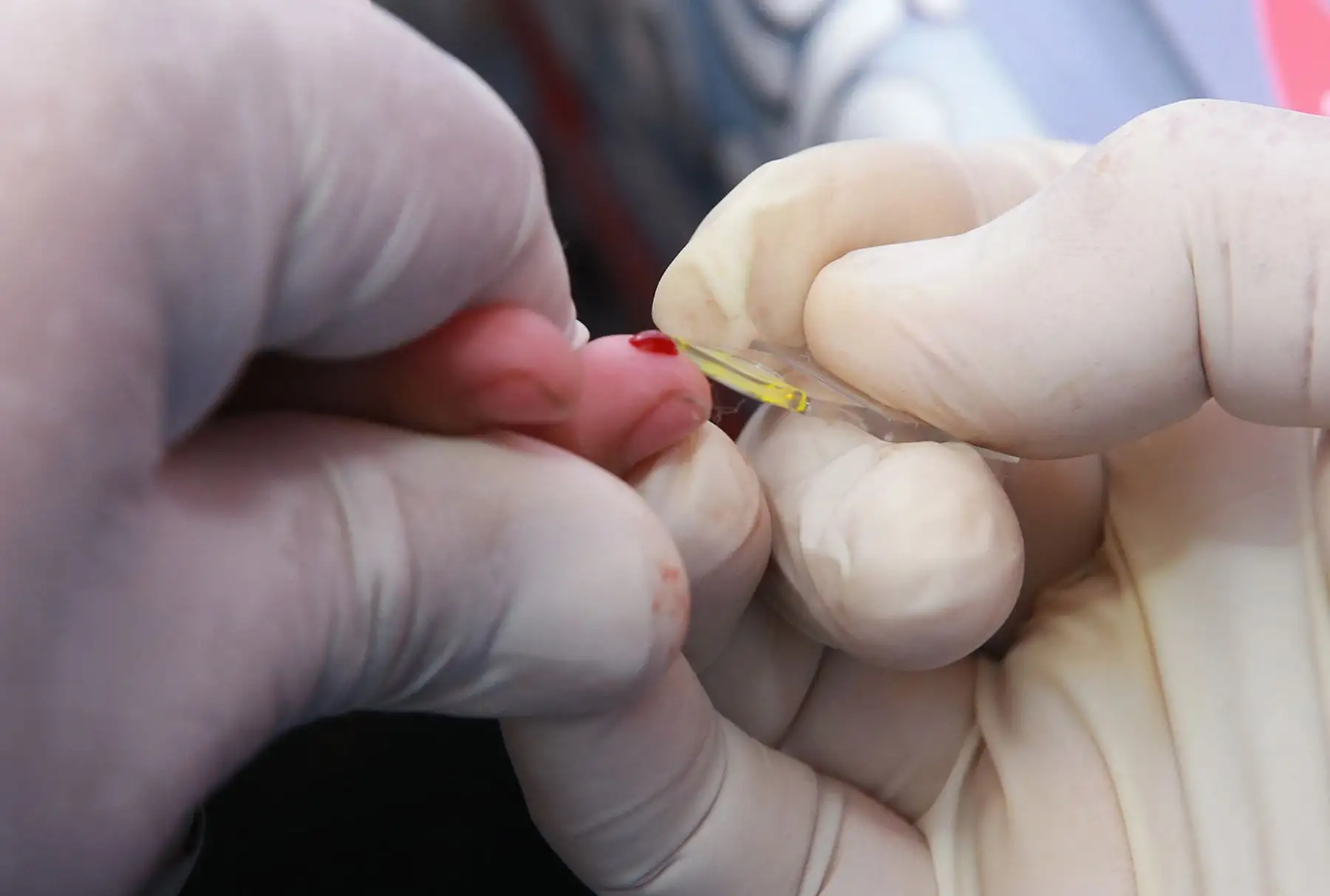 Toma de muestras de sangre a niños, en la Cuarta Jornada Nacional  contra la Anemia en el Agustino. Foto: ANDINA/Norman Córdova