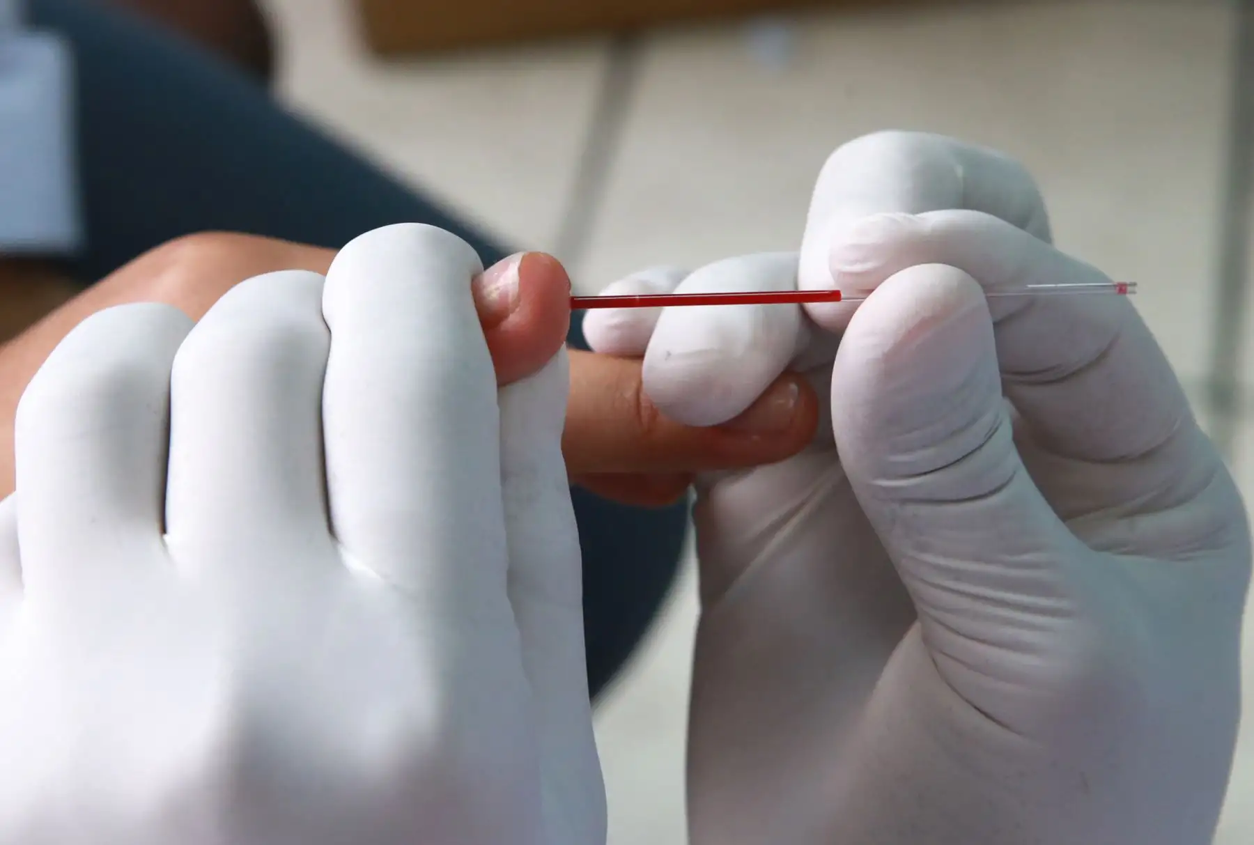 Los niños que necesitan  de la transfusión de sangre del nosocomio, provienen de provincia y no cuentan con familiares que puedan realizar la donación para sus intervenciones, quirúrgicas .Foto: ANDINA/Norman Córdova