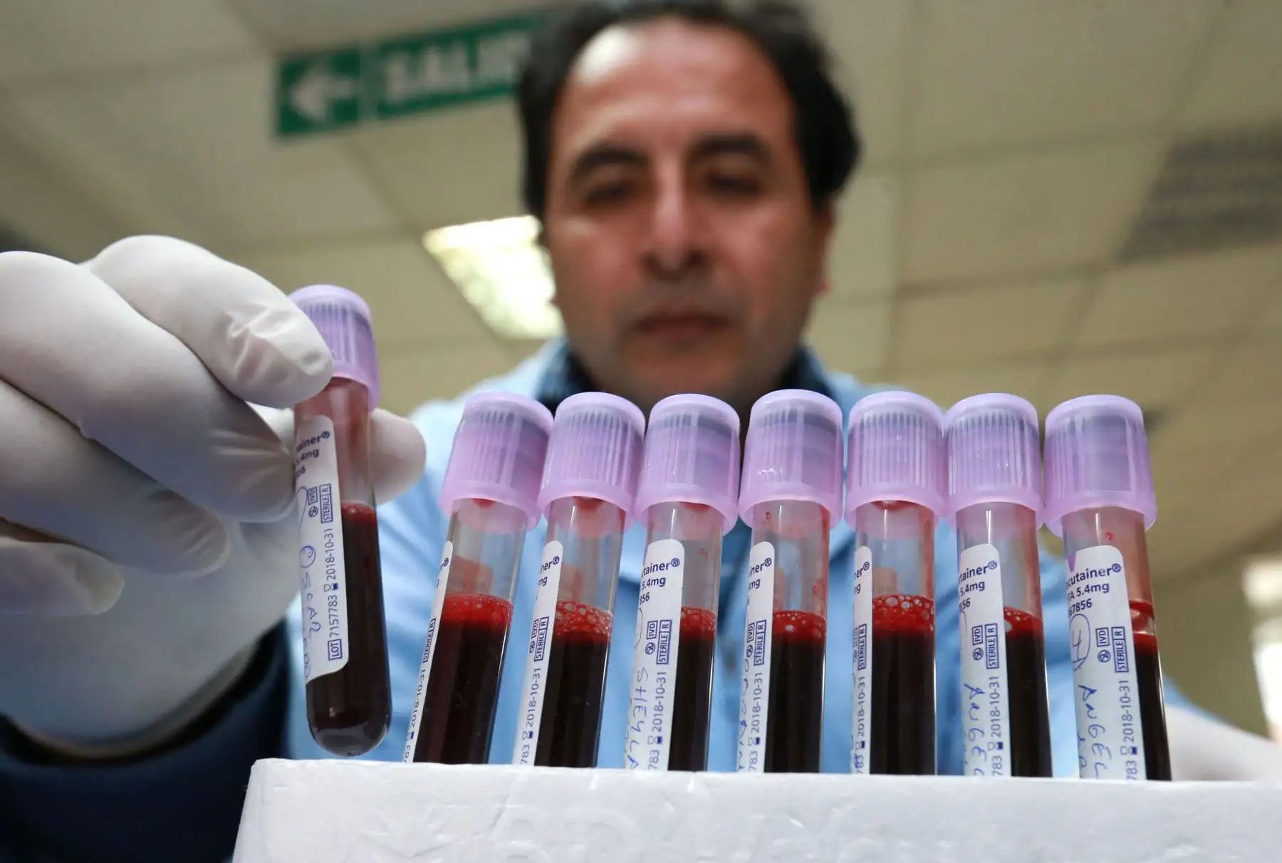 El centro de Hemoterapia y Banco de Sangre es un servicio especializado en el área de medicina transfusional, cuya función principal es la obtención de sangre y componentes sanguíneos destinados a dar soporte transfusional seguro, oportuno y de calidad; que permitan atender los requerimientos de los pacientes en el Instituto Nacional del Niño .Foto: ANDINA/Norman Córdova