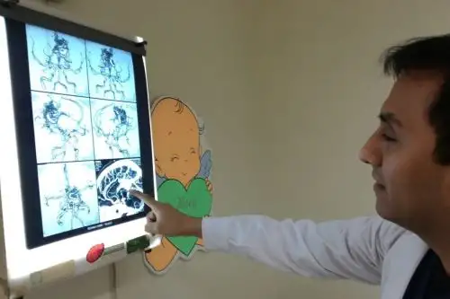 ¡Cuidado!, niños también pueden sufrir de aneurisma cerebral. Foto: ANDINA/Difusión.