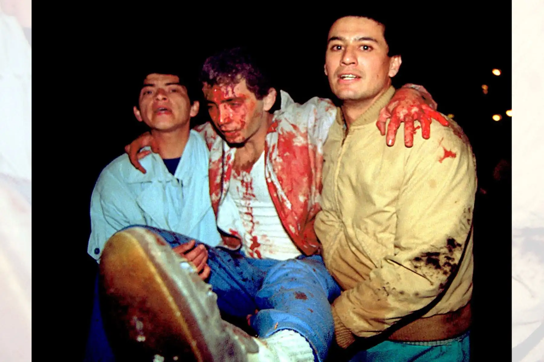 Heridos por atentado terrorista perpetrado por Sendero Luminoso con coche bomba en la calle Tarata de Miraflores el 16 de julio de 1992. Foto: AFP