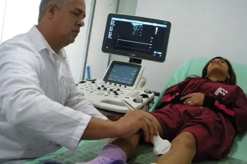 Las varices afectan sobre todo a personas sedentarias y que jo tienen alimentación saludable.