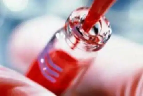 Conoce los síntomas de la leucemia y cómo detectarlo. Foto: ANDINA/archivo.
