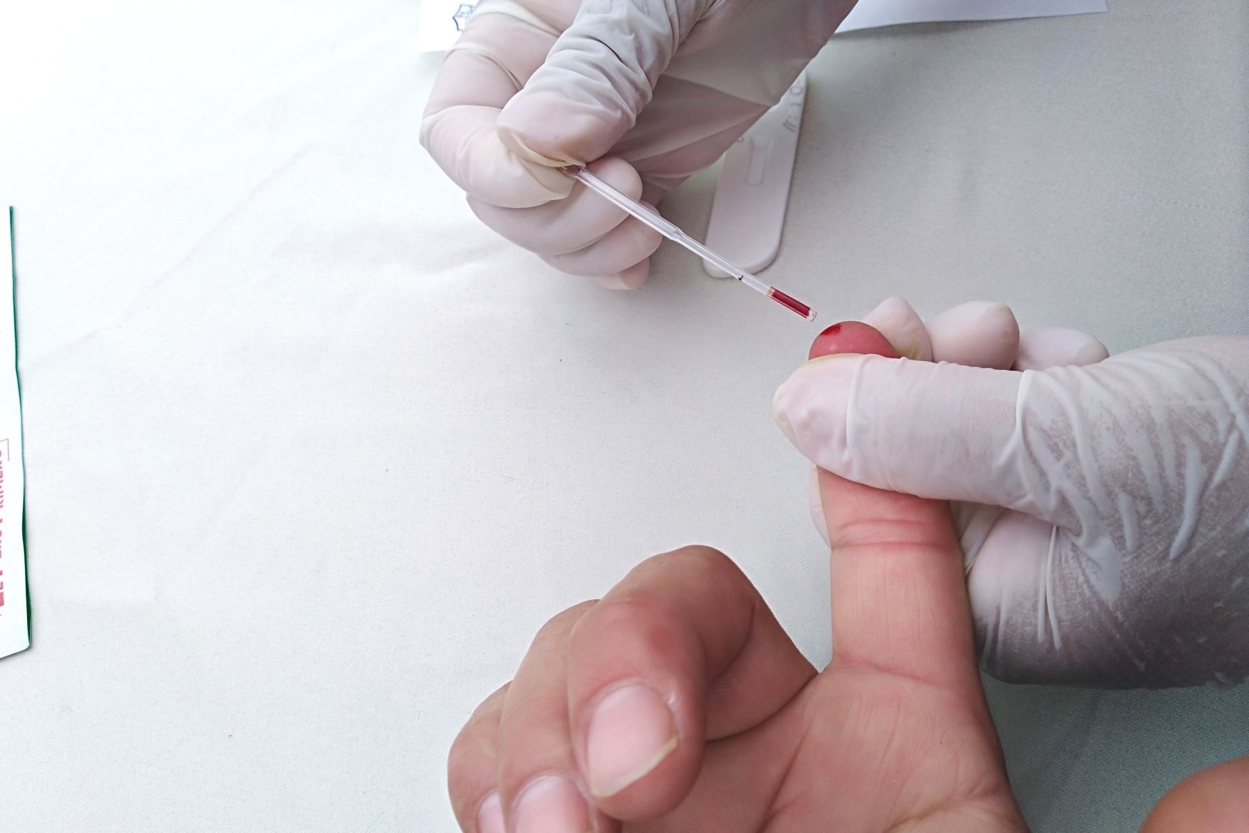 Callao brindará pruebas gratuitas para prevención y control de VIH. Foto: ANDINA/Difusión.