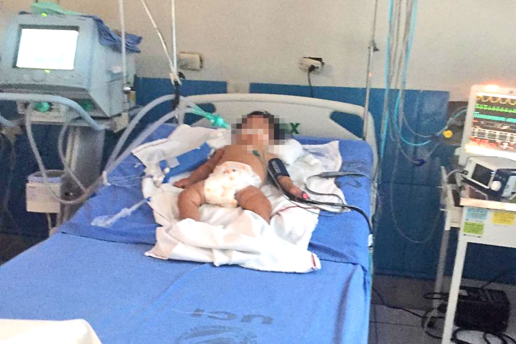 Falleció la bebé de nueve meses golpeada salvajemente por su padrastro. ANDINA/Pedro Tinoco