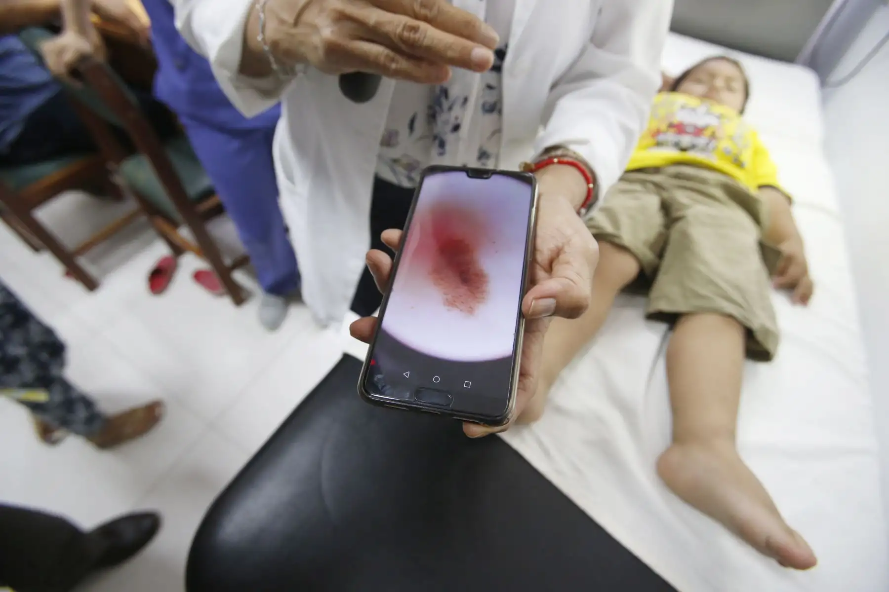 Instituto de Salud del Niño (INSN), inicia campaña de evaluación gratis de lunares, manchas y lesiones. Jornada que se lleva a cabo por el Día del Lunar. Foto: ANDINA/Nathalie Sayago