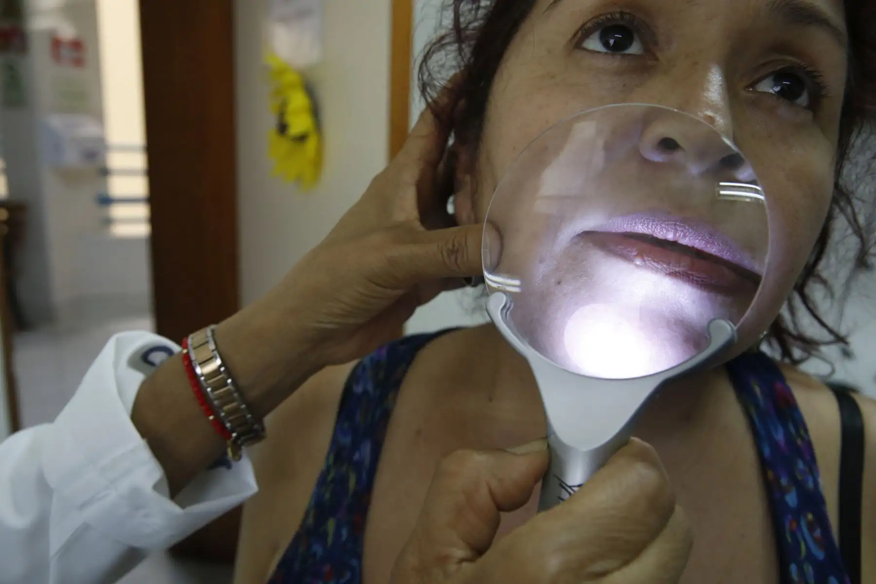 Instituto de Salud del Niño (INSN), inicia campaña de evaluación gratis de lunares, manchas y lesiones. Jornada que se lleva a cabo por el Día del Lunar. Foto: ANDINA/Nathalie Sayago