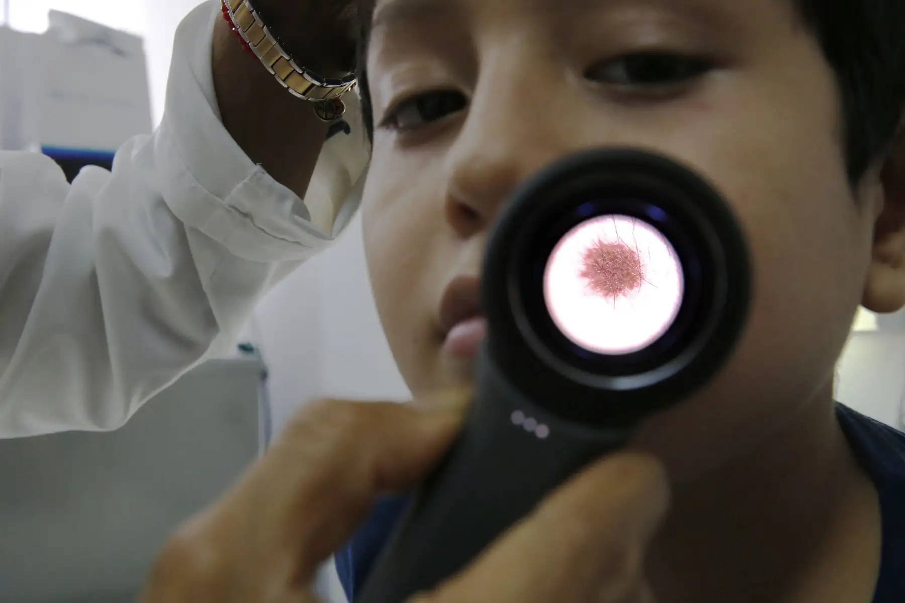 Instituto de Salud del Niño (INSN), inicia campaña de evaluación gratis de lunares, manchas y lesiones. Jornada que se lleva a cabo por el Día del Lunar. Foto: ANDINA/Nathalie Sayago
