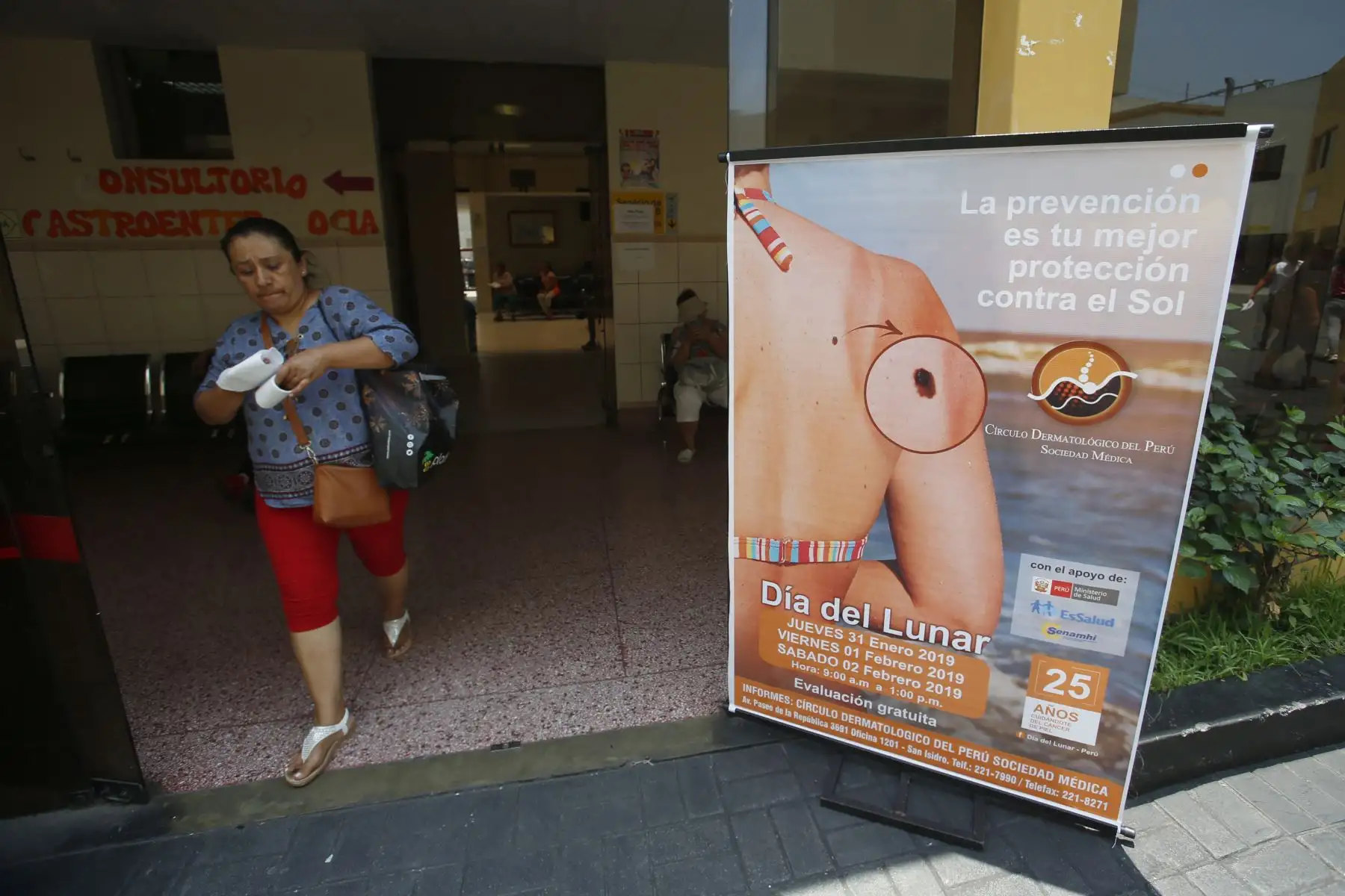 Instituto de Salud del Niño (INSN), inicia campaña de evaluación gratis de lunares, manchas y lesiones. Jornada que se lleva a cabo por el Día del Lunar. Foto: ANDINA/Nathalie Sayago