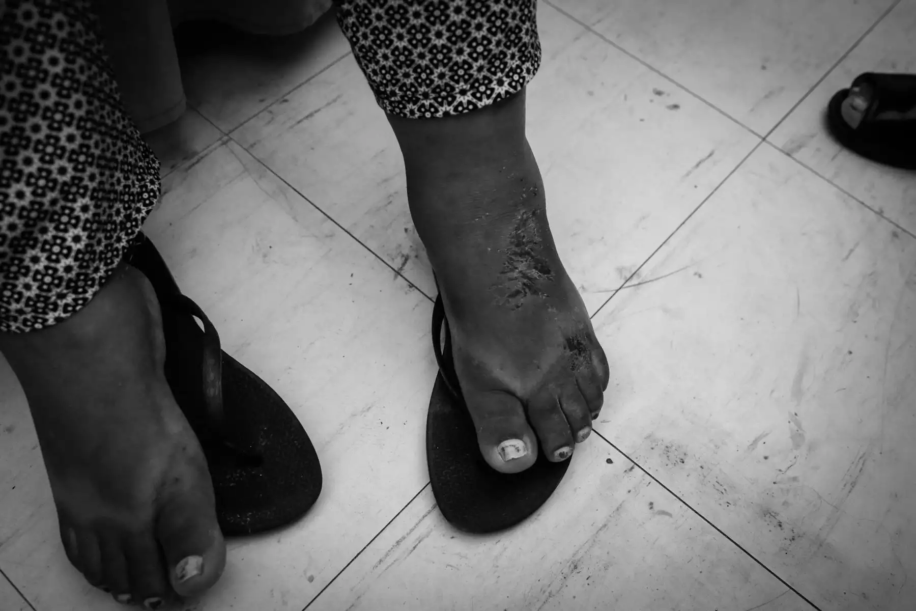 Eliana, la madre, sufrió heridas en varias partes del cuerpo.  Foto: ANDINA/Nathalie Sayago