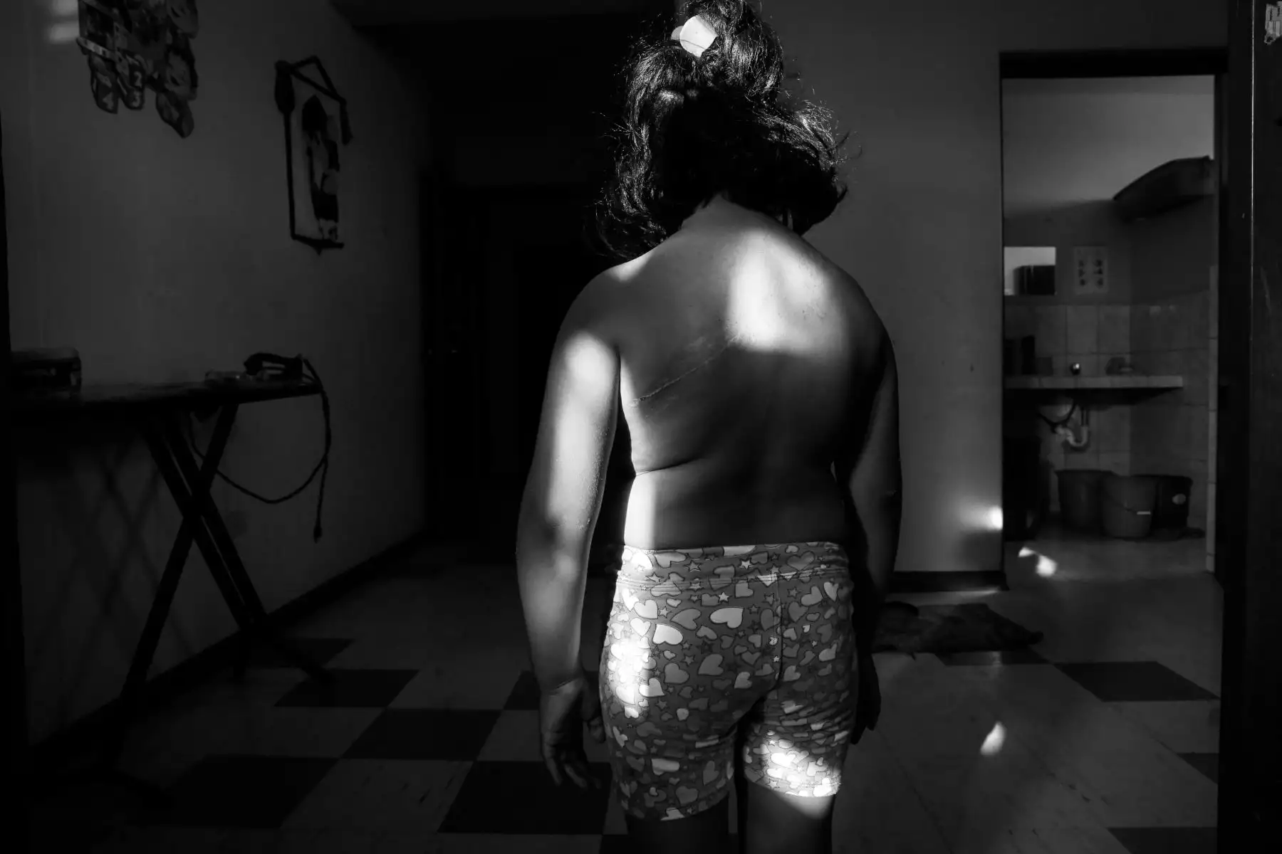 La pequeña Milagritos tuvo la suerte de ser la menos afectada. Solo sufrió heridas leves.  Foto: ANDINA/Nathalie Sayago
